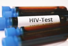 HIV diagnosi