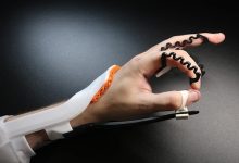 Flexible Low-Profile Orthosis