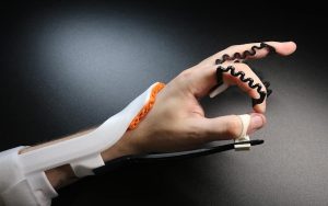 Flexible Low-Profile Orthosis