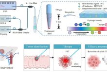 sonda a fibra ottica cura del tumore