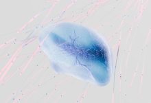 neuroni